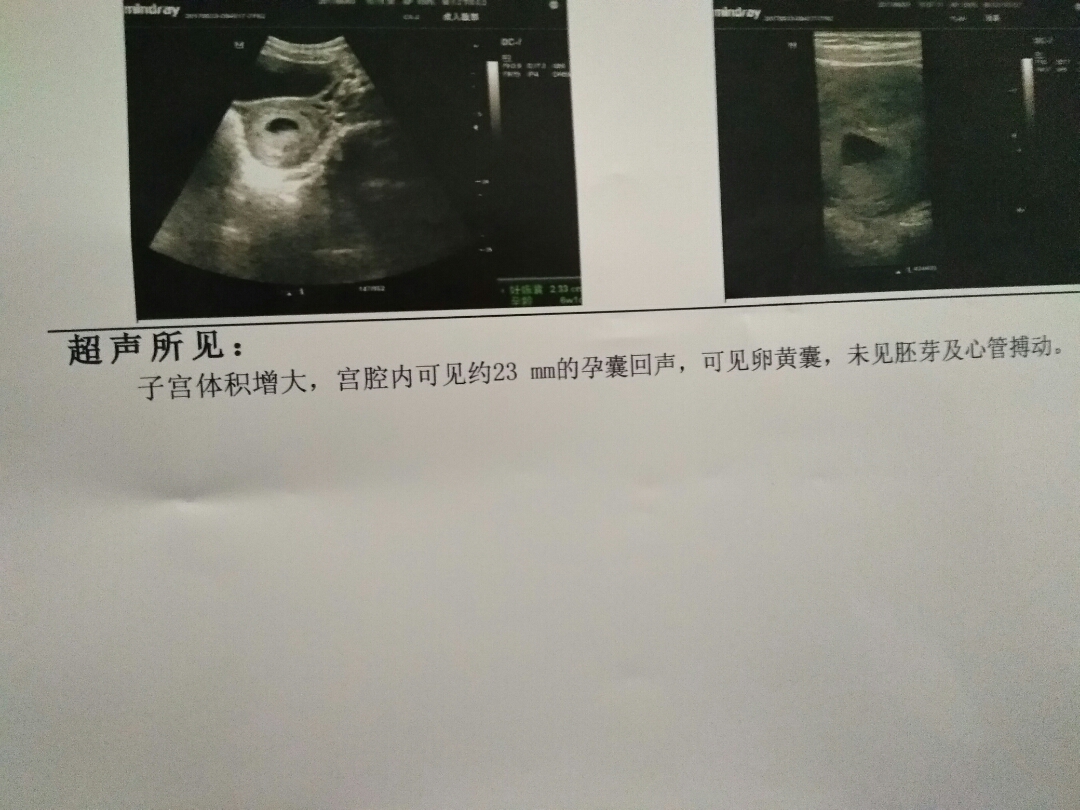 好运来健康男性供卵试管婴儿：男性准备生健康宝宝应从戒烟开始