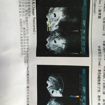 好运来健康男性供卵试管婴儿：男性准备生健康宝宝应从戒烟开始