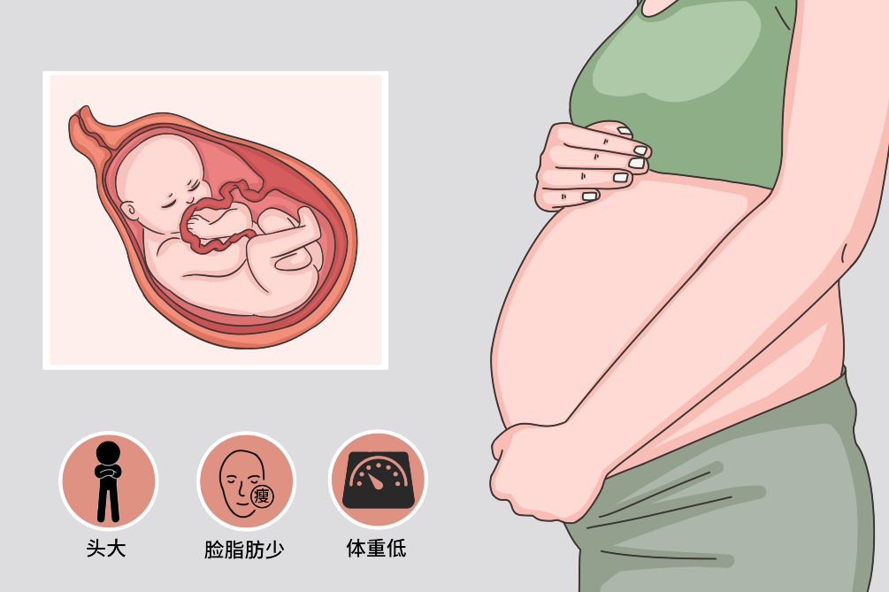 卵巢早衰会影响病人做供卵做试管婴儿的成功率吗？当然是这样!