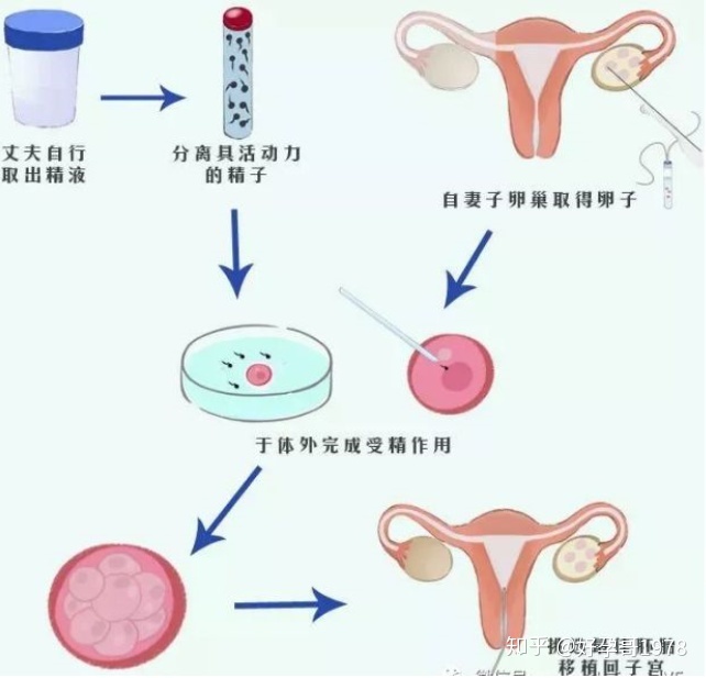 做供卵助孕代怀试管不需要结婚证（长沙做供卵试管代生费用不需要结婚证的医院）