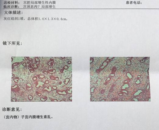为什么我做借卵代怀试管供卵的卵子比较少？卵子越多越好吗？