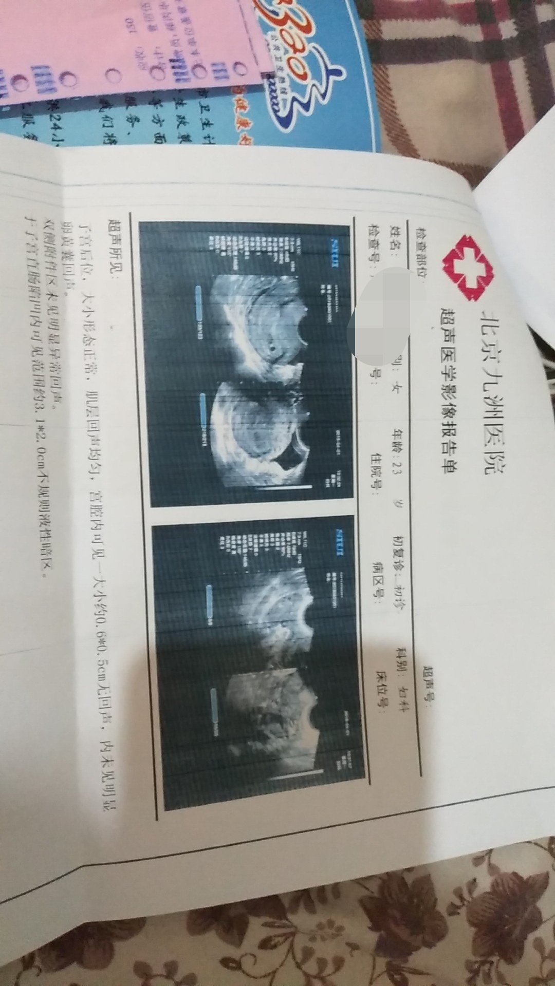 做供卵借卵做试管代怀的男人要注意什么？