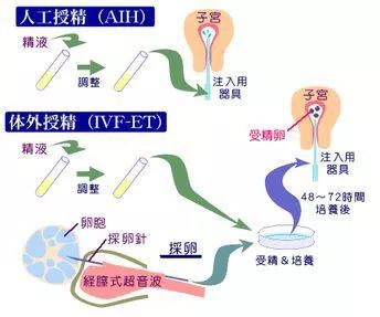 做供卵试管女性什么时候去检查最合适