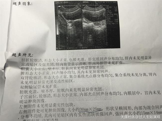 江西南昌江西南昌借卵试管婴儿医院