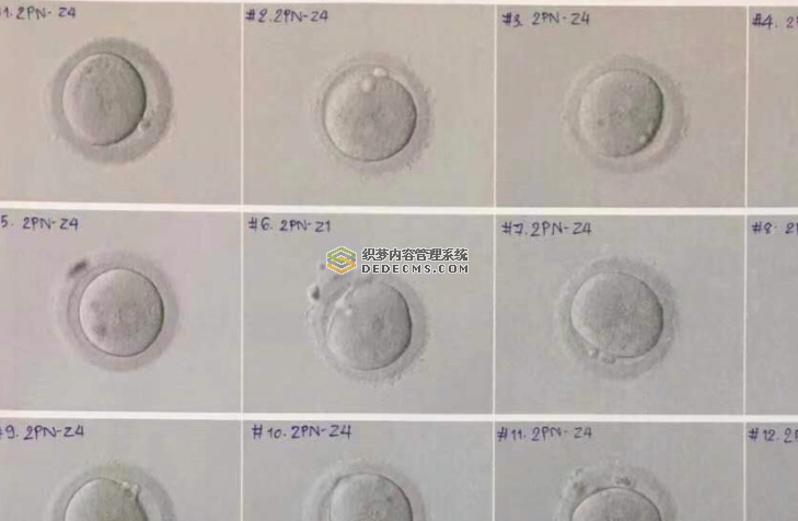 二代试管婴儿选男女