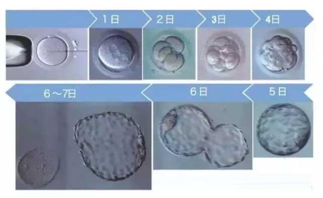 南昌中心妇产医院进行试管取卵有全麻吗？