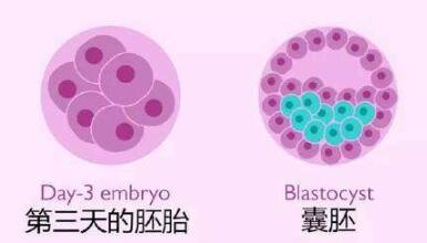 辅助生殖与试管的区别