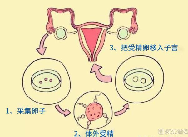 南昌失独家庭做第三代试管代怀是什么意思政府有补贴政策吗？