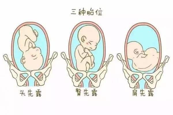 高龄合法试管代怀中心前怎样调理卵巢功能（需做到这5点）