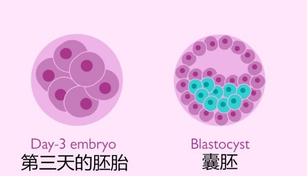 供精试管可以移植双胞胎吗