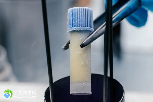 排卵期备孕注意事项女性排卵期备孕注意事项